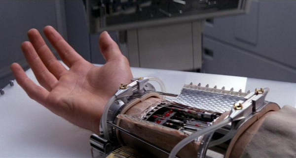 «Бионические» протезы: какие органы сегодня можно подменить электроникой