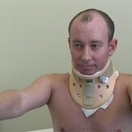 Пациенту вживили первый в России нанопозвоночник