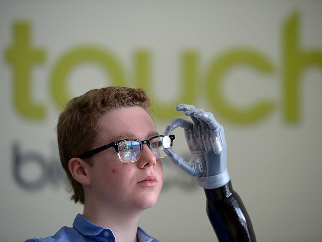 13-летний подросток, лишившийся руки, получил один из первых в мире сенсорных протезов