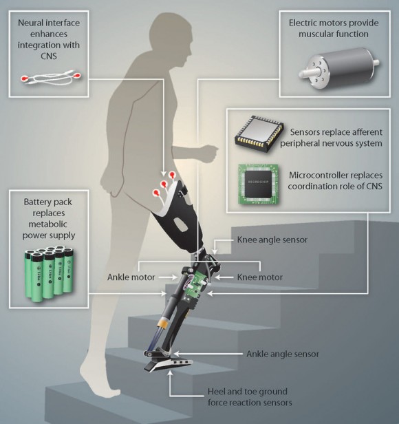     Основные элементы бионического протеза