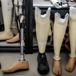 Создан протез ноги, который интегрируется непосредственно в кость