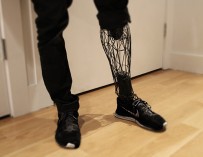 3D печатный екзо-протез ноги сочетает в себе эстетичность и доступность
