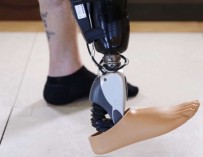 Исландская компания успешно протестировала «бионическую ногу»