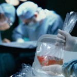 Трансплантация органов в Росии: по закону мы все согласны