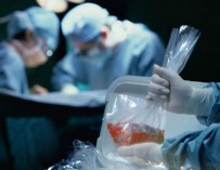 Трансплантация органов в Росии: по закону мы все согласны