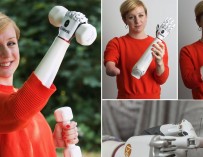 Первые миниатюрные бионические руки примерили женщина и подросток