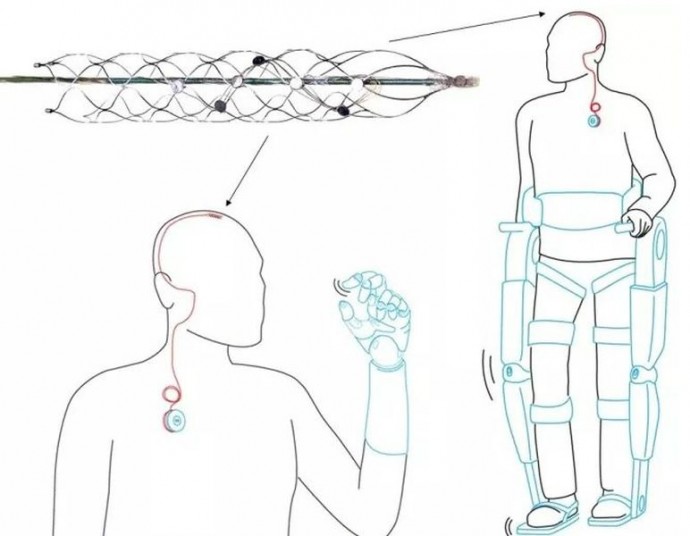     Новое устройство передаёт сигналы, полученные от головного мозга человека, в процессор, управляющий протезом или экзоскелетом (иллюстрация University of Melbourne).
