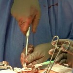 Уникальная операция в Петербурге: впервые в мире хирурги заменили шейные позвонки протезом