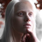 Белоруска-альбинос: “Родители с детства говорили мне, что я уникальна”